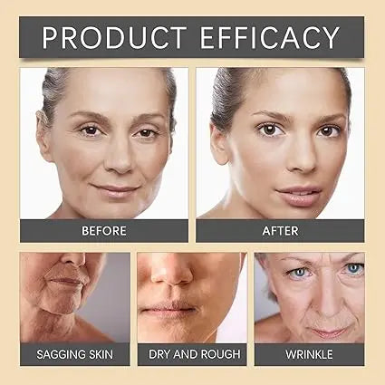 Botox Bee Venom Anti-Wrinkle Cream Ifrah Souq
