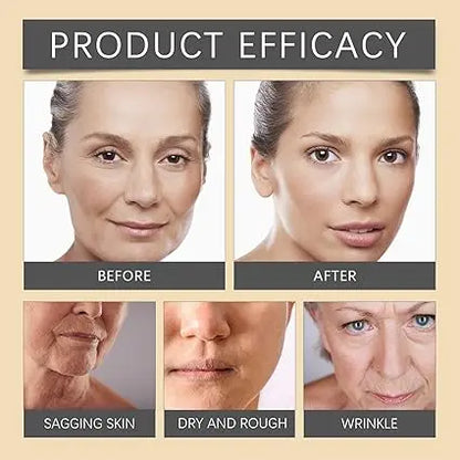 Botox  Bee Venom Anti-Wrinkle Cream Ifrah Souq